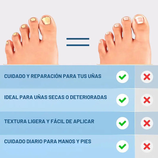 CREMA REPARADORA PARA UÑAS ™
